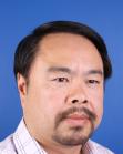 After Hair Transplant&nbsp;Front